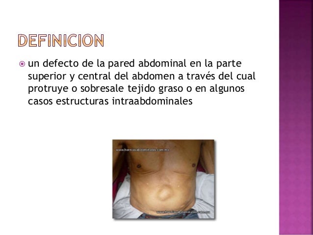hernia encarcelada